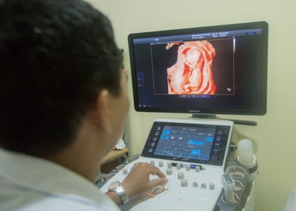 Ở mốc siêu âm 16 tuần mẹ bầu có thể cảm nhận được các cử động của thai nhi