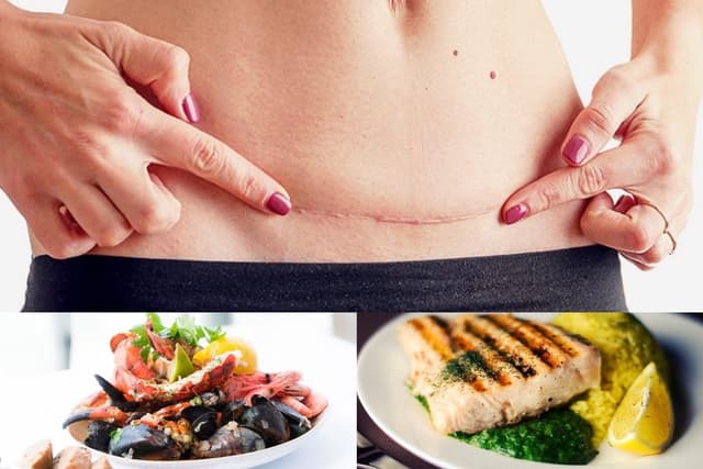 Phụ nữ sau khi sinh mổ bao lâu được ăn hải sản?