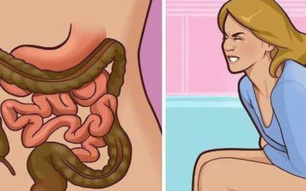 Tầm soát ung thư đại trực tràng như thế nào