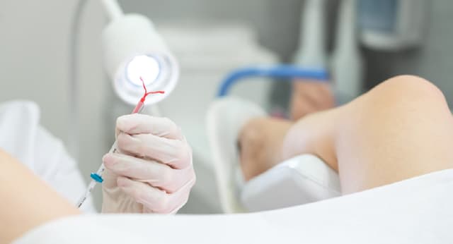 Tháo vòng tránh thai và những điều chị em cần biết