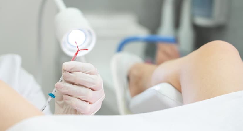 Tháo vòng tránh thai và những điều chị em cần biết