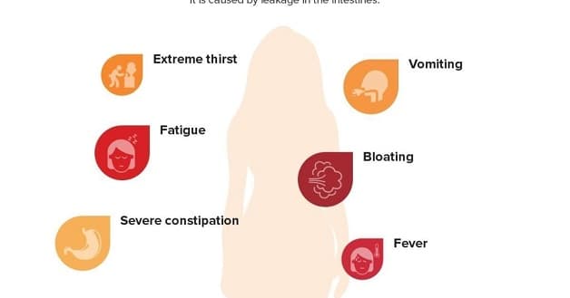 Triệu chứng bệnh viêm phúc mạc