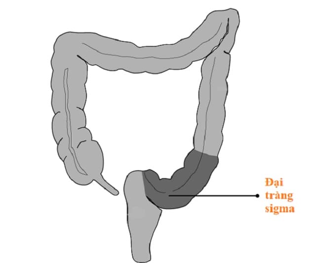 đại tràng sigma