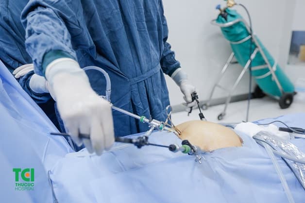 Viêm ruột thừa khi nào thì phải mổ và phương pháp điều trị