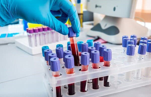 Xét nghiệm ung thư ở đâu tốt