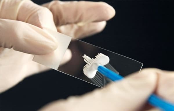 Chọn nơi xét nghiệm ung thư ở đâu cho đúng