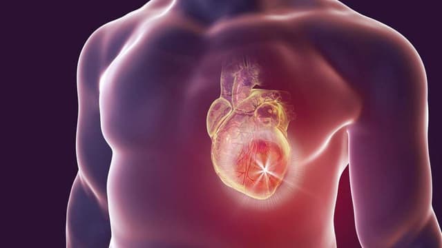 Những điều cần biết về bệnh suy vành tim không thể bỏ qua