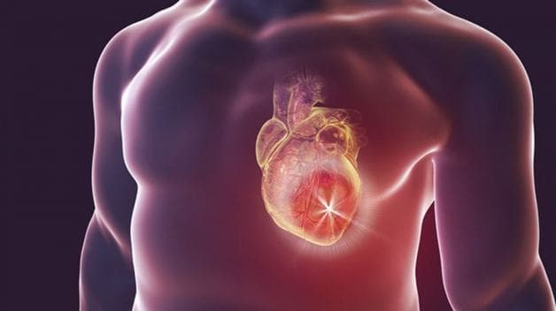 Suy vành tim là cách gọi khác của bệnh động mạch vành.