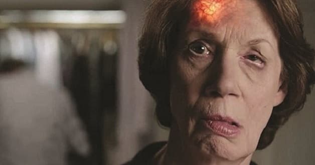 Thiếu máu não cục bộ thoáng qua thường rất ít biểu hiện triệu chứng rõ ràng, khiến người bệnh khó nhận diện.