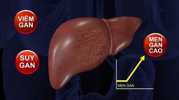 Cách hạ men gan là gì?