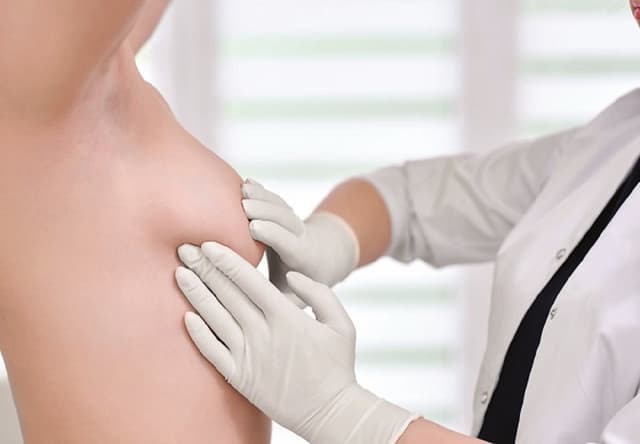 Cách điều trị áp xe vú hiệu quả cho phụ nữ sau sinh