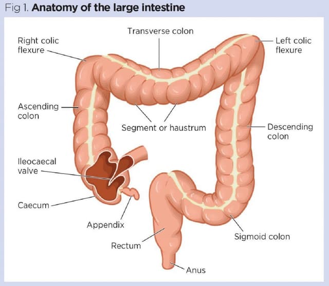 6 câu hỏi về viêm đại tràng co thắt thường gặp và câu trả lời