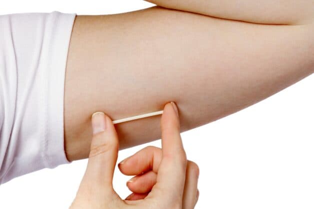 cấy que tránh thai có đau không