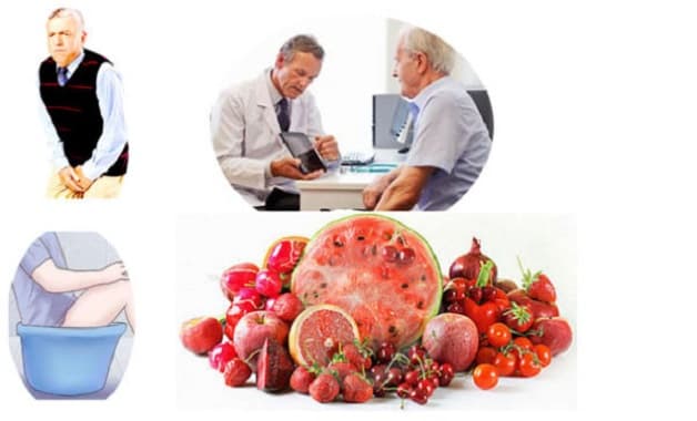 Khám kiểm tra u xơ tiền liệt tuyến