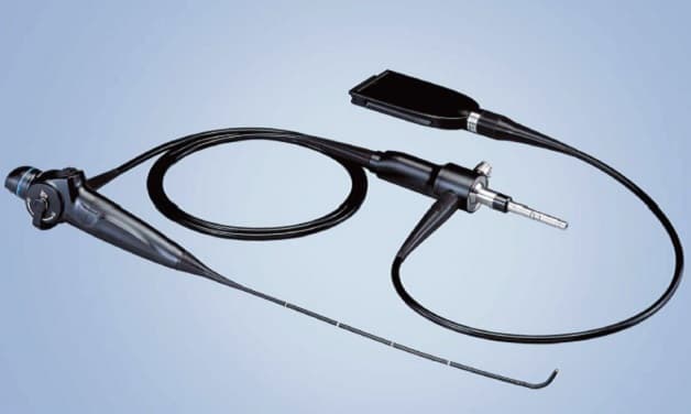 Ống nội soi qua đường mũi