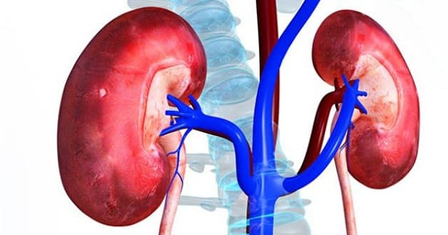 Suy thận là biến chứng nguy hiểm nhất khi sỏi thận rơi xuống đường tiết niệu