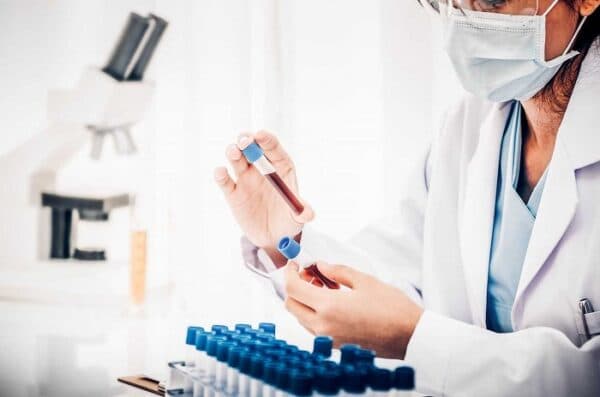 xét nghiệm AFP thích hợp với ai