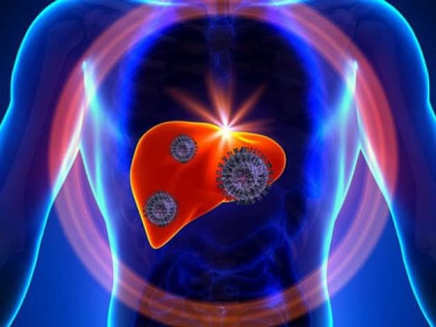 Viêm gan B và C mạn tính