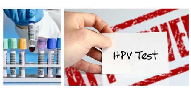 Xét nghiệm HPV- phương pháp sàng lọc ung thư cổ tử cung