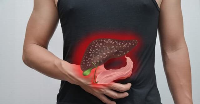 Xơ gan F4 là gì? Nguyên nhân và triệu chứng của bệnh