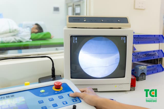 Tán sỏi ngoài cơ thể không đau, không mổ, không nằm viện