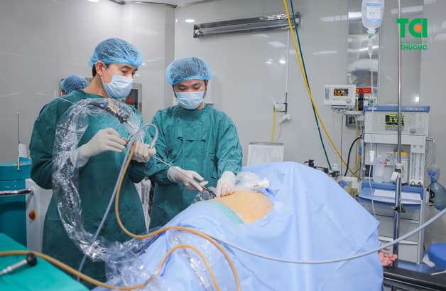 Tán sỏi qua da giá bao nhiêu phụ thuộc vào chi phí ca phẫu thuật, phí dịch vụ cùng các chi phí trước và sau tán sỏi khác