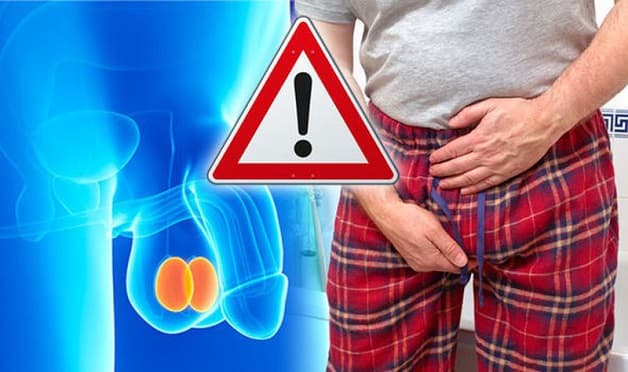 Giãn mạch tinh hoàn gây ra đau tinh hoàn kéo dài