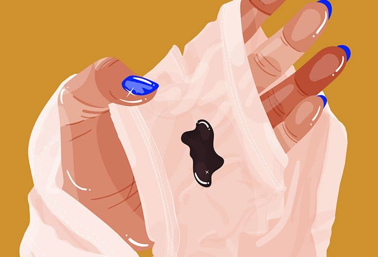 Kinh nguyệt không đều ra máu đen là hiện tượng bất thường cần lưu ý