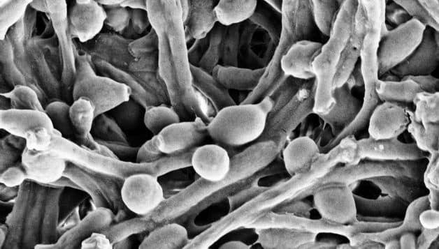 bệnh nấm miệng ở trẻ em