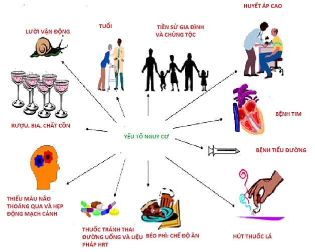 Các yếu tố nguy cơ gây đột quỵ não bao gồm tuổi, tiền sử gia đình, các bệnh lý, thói quen xấu