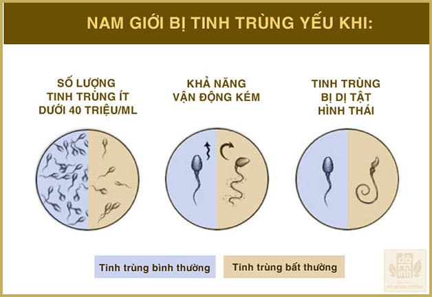 Tinh trùng yếu được đánh giá qua ba yếu tố số lượng, hình thái, khả năng vận động.