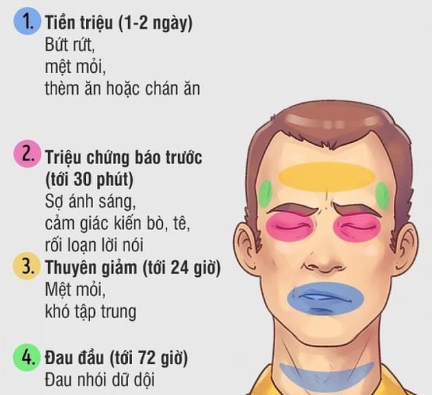Các triệu chứng của bệnh đau nửa đầu.