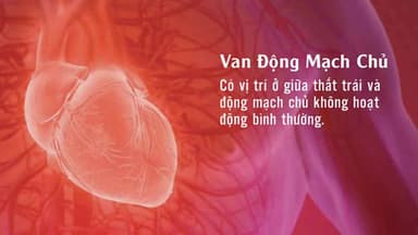 Bệnh van động mạch chủ là gì? Nguyên nhân và dấu hiệu