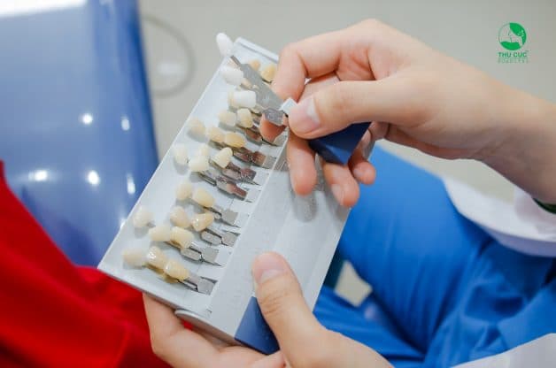 Bác sĩ cho bệnh nhân xem thang đo để biết được mức độ ố vàng của răng hiện tại