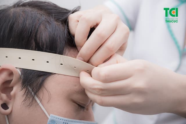 Khám nội thần kinh cùng chuyên gia giỏi