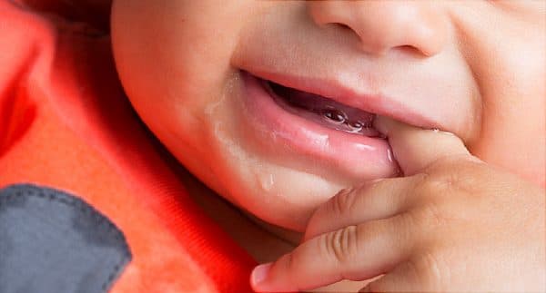 Dấu hiệu trẻ mọc răng