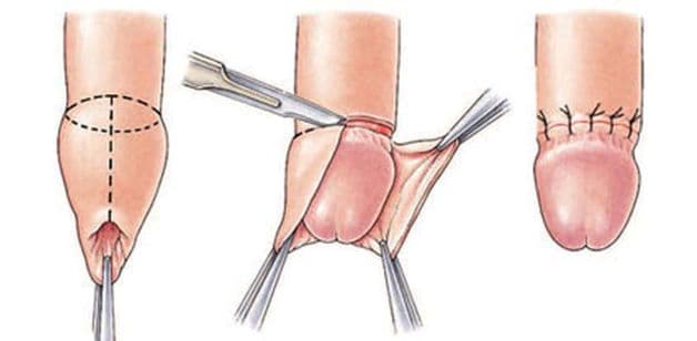 Toàn bộ quy trình được thực hiện trong khoảng thời gian chưa đến 30 phút.