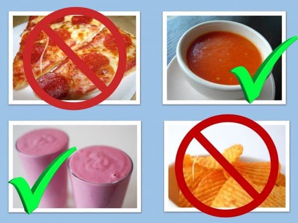 Nhổ răng số 8 kiêng gì