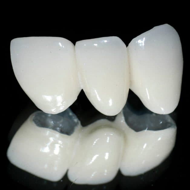 Cercon Zirconia có lớp sườn bên trong được chế tạo bởi vật liệu hiếm Zirconia