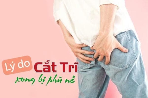 Cắt trĩ xong bị phù nề có nhiều nguyên nhân khác nhau