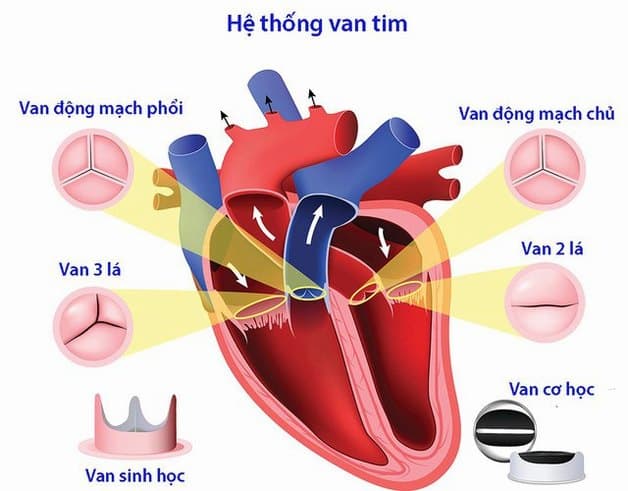 Điều trị can thiệp phẫu thuật