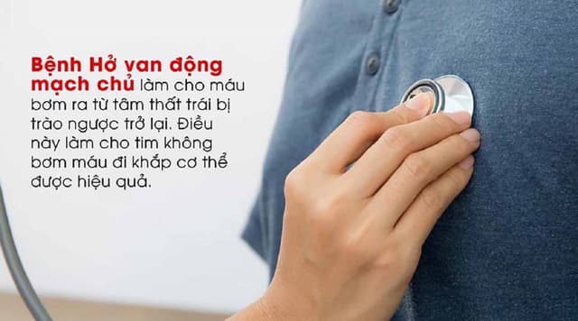 Hở van động mạch chủ nhẹ: Chớ coi thường!