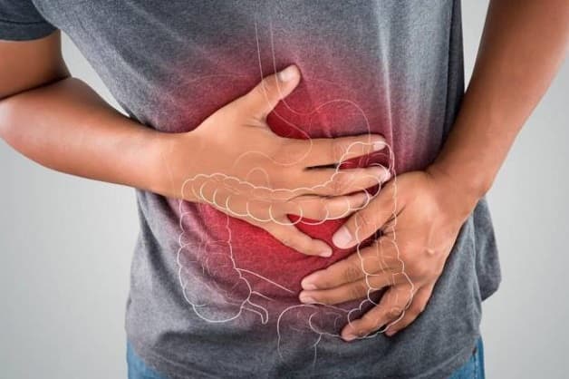 Hội chứng ruột kích thích là gì và có những dấu hiệu nào?