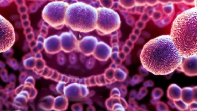 Thấp tim là nguyên nhân chủ yếu gây hở van động mạch chủ nhẹ