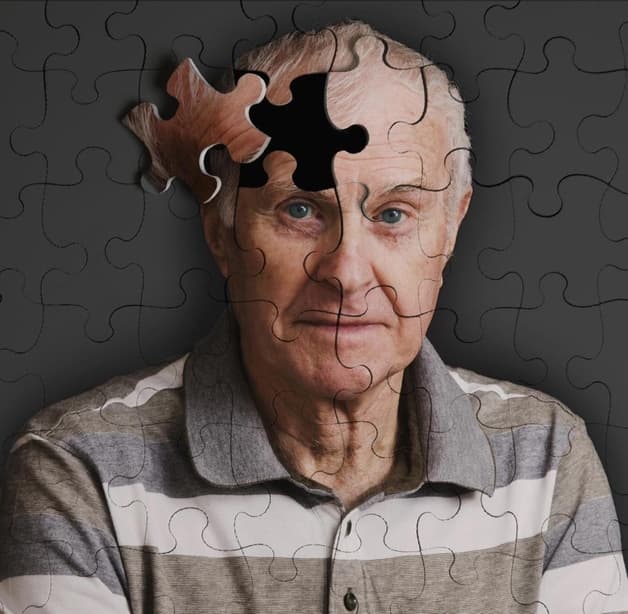 Suy giảm trí nhớ là gì 