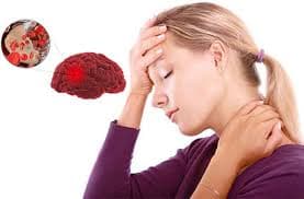 thiếu máu lên não triệu chứng khiến nhiều người chủ quan bỏ qua nên gặp nguy hiểm