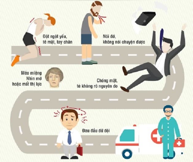 Những triệu chứng chúng ta có thể dễ dàng bắt gặp ở những bệnh nhân bị đột quỵ nhồi máu não