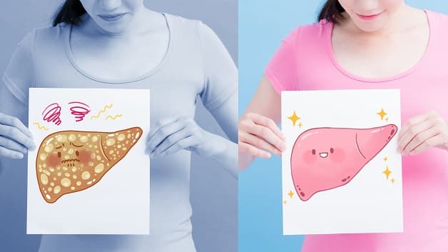 Xét nghiệm men gan phát hiện men gan cao