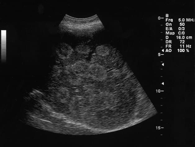 Siêu âm là phương phát chẩn đoán bệnh đơn giản, chính xác.