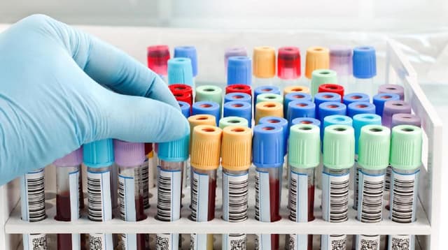 Bao giờ bạn nên thực hiện xét nghiệm HBV?